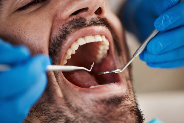 Best Emergency Denture Repair in Troy, AL
